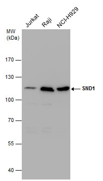 SND1 antibody detects SND1 protein by western blot analysis. Various whole cell extracts (30 μg) were separated by 7.5% SDS-PAGE, and the membrane was blotted with SND1 antibody (GTX130136) diluted at a dilution of 1:1000.