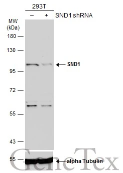Non-transfected (–) and transfected (+) 293T whole cell extracts (50 μg) were separated by 7.5% SDS-PAGE, and the membrane was blotted with SND1 antibody (GTX130136) diluted at 1:2000. The HRP-conjugated anti-rabbit IgG antibody (GTX213110-01) was used to detect the primary antibody, and the signal was developed with Trident ECL plus-Enhanced.
