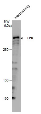 TPR antibody detects TPR protein by western blot analysis. Mouse tissue extracts (30 μg) was separated by 5 % SDS-PAGE, and the membrane was blotted with TPR antibody (GTX130142) at a dilution of 1:500.