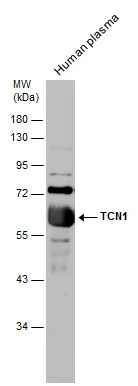 Human tissue extract (30 μg) was separated by 10% SDS-PAGE, and the membrane was blotted with TCN1 antibody (GTX130151) diluted at 1:500.