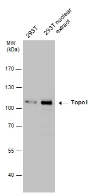 Topo I antibody detects Topo I protein by western blot analysis. 293T whole cell extracts and nuclear extracts (5 ug) were separated by 7.5% SDS-PAGE,and the membrane was blotted with Topo I antibody (GTX130177) at a dilution of 1:2000.