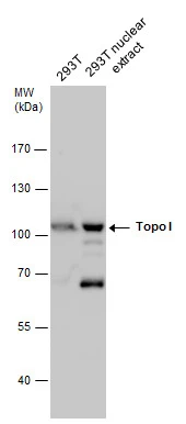 Topo I antibody detects Topo I protein by western blot analysis. 293T whole cell extracts and nuclear extracts (5 ug) were separated by 7.5% SDS-PAGE,and the membrane was blotted with Topo I antibody (GTX130178) at a dilution of 1:2000.