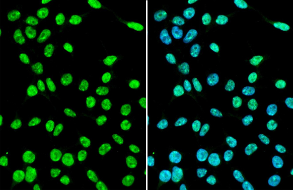 SUZ12 antibody detects SUZ12 protein at nucleus by immunofluorescent analysis. Sample: 293T cells were fixed in 4% paraformaldehyde at RT for 15 min. Green: SUZ12 stained by SUZ12 antibody (GTX130179) diluted at 1:500. Blue: Fluoroshield with DAPI (GTX30920).