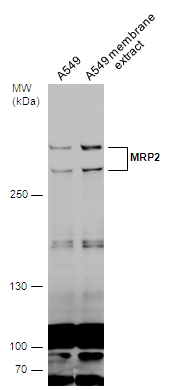A549 whole cell and membrane extracts (30 μg) were separated by 5% SDS-PAGE, and the membrane was blotted with MRP2 antibody (GTX130181) diluted at 1:500. The HRP-conjugated anti-rabbit IgG antibody (GTX213110-01) was used to detect the primary antibody. A549 whole cell and membrane extracts (30 μg) were separated by 5% SDS-PAGE, and the membrane was blotted with MRP2 antibody (GTX130181) diluted at 1:500. The HRP-conjugated anti-rabbit IgG antibody (GTX213110-01) was used to detect the primary antibody.