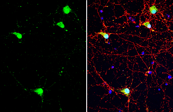 iNOS antibody detects iNOS protein by immunofluorescent analysis. Sample: DIV10 rat E18 primary cortical neuron cells were fixed in 4% paraformaldehyde at RT for 15 min. Green: iNOS stained by iNOS antibody (GTX130182) diluted at 1:500. Red: Tau, stained by Tau antibody [GT287] (GTX634809) diluted at 1:500. Blue: Fluoroshield with DAPI (GTX30920).