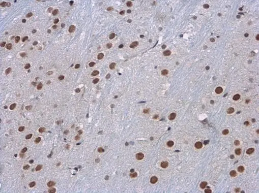 SETD1A antibody detects SETD1A protein at nucleus in mouse brain by immunohistochemical analysis. Sample: Paraffin-embedded mouse brain. SETD1A antibody (GTX130194) diluted at 1:500. 
 Antigen Retrieval: Citrate buffer, pH 6.0, 15 min