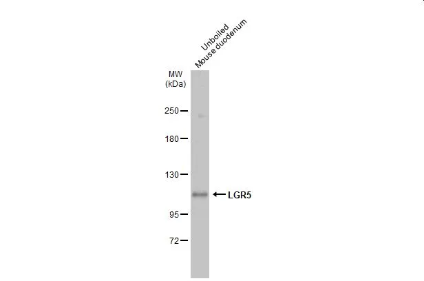Unboiled mouse tissue extract (50 μg) was separated by 5% SDS-PAGE, and the membrane was blotted with LGR5 antibody (GTX130204) diluted at 1:500. The HRP-conjugated anti-rabbit IgG antibody (GTX213110-01) was used to detect the primary antibody, and the signal was developed with Trident ECL plus-Enhanced.