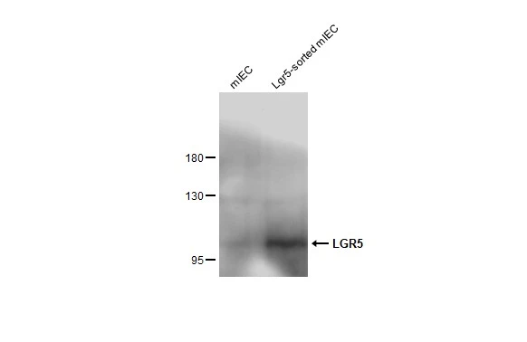 Various whole cell extracts (2 μg) were separated by 5% SDS-PAGE, and the membrane was blotted with LGR5 antibody (GTX130204) diluted at 1:1000. The HRP-conjugated anti-rabbit IgG antibody (GTX213110-01) was used to detect the primary antibody.