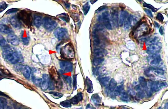 LGR5 antibody detects LGR5 protein at cell membrane and cytoplasm by immunohistochemical analysis. Sample: Paraffin-embedded mouse intestine. LGR5 stained by LGR5 antibody (GTX130204) diluted at 1:25. Antigen Retrieval: Citrate buffer, pH 6.0, 5 min