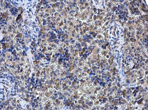 SHOC2 antibody detects SHOC2 protein at cytoplasm in mouse spleen by immunohistochemical analysis. Sample: Paraffin-embedded mouse spleen. SHOC2 antibody (GTX130206) diluted at 1:500. 
 Antigen Retrieval: Citrate buffer, pH 6.0, 15 min