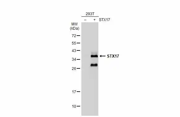 Non-transfected (–) and transfected (+) 293T whole cell extracts (30 μg) were separated by 12% SDS-PAGE, and the membrane was blotted with STX17 antibody (GTX130212) diluted at 1:5000. The HRP-conjugated anti-rabbit IgG antibody (GTX213110-01) was used to detect the primary antibody.