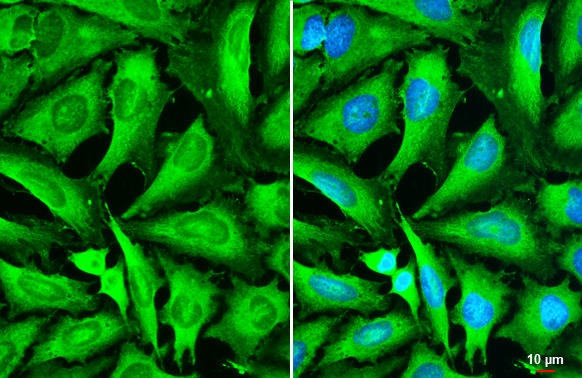 STX17 antibody detects STX17 protein by immunofluorescent analysis. Sample: HeLa cells were fixed in 4% paraformaldehyde at RT for 15 min. Green: STX17 stained by STX17 antibody (GTX130212) diluted at 1:500. Blue: Fluoroshield with DAPI (GTX30920). Scale bar= 10 μm.
