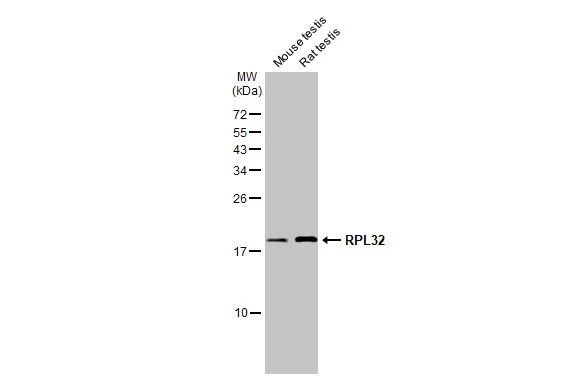 Various tissue extracts (50 μg) were separated by 15% SDS-PAGE, and the membrane was blotted with RPL32 antibody (GTX130214) diluted at 1:1000. The HRP-conjugated anti-rabbit IgG antibody (GTX213110-01) was used to detect the primary antibody. Various tissue extracts (50 μg) were separated by 15% SDS-PAGE, and the membrane was blotted with RPL32 antibody (GTX130214) diluted at 1:1000. The HRP-conjugated anti-rabbit IgG antibody (GTX213110-01) was used to detect the primary antibody.