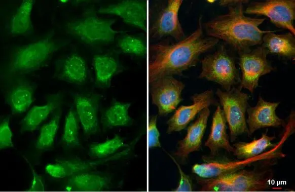 RPL32 antibody detects RPL32 protein at endoplasmic reticulum by immunofluorescent analysis. Sample: HeLa cells were fixed in 4% paraformaldehyde at RT for 15 min. Green: RPL32 stained by RPL32 antibody (GTX130214) diluted at 1:500. Red: alpha Tubulin, a cytoskeleton marker, stained by alpha Tubulin antibody [GT114] (GTX628802) diluted at 1:1000. Blue: Fluoroshield with DAPI (GTX30920).