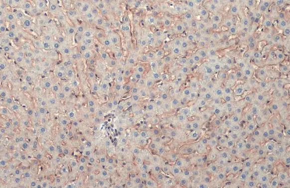 COL4A1 antibody detects COL4A1 protein at cytoplasm and nucleus by immunohistochemical analysis. Sample: Paraffin-embedded rat liver. COL4A1 stained by COL4A1 antibody (GTX130215) diluted at 1:2000. Antigen Retrieval: Citrate buffer, pH 6.0, 15 min