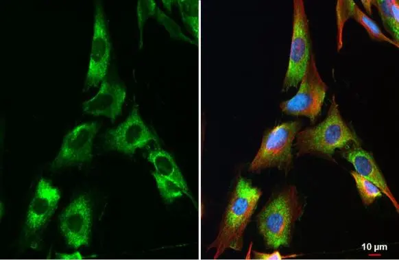 COL4A1 antibody detects COL4A1 protein at vesicle by immunofluorescent analysis. Sample: SK-N-SH cells were fixed in 4% paraformaldehyde at RT for 15 min. Green: COL4A1 stained by COL4A1 antibody (GTX130215) diluted at 1:500. Red: alpha Tubulin, a cytoskeleton marker, stained by alpha Tubulin antibody [GT114] (GTX628802) diluted at 1:1000. Blue: Fluoroshield with DAPI (GTX30920).