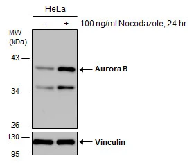 Untreated (–) and treated (+) HeLa whole cell extracts (30 μg) were separated by 10% SDS-PAGE, and the membrane was blotted with Aurora B antibody (GTX130238) diluted at 1:1000.