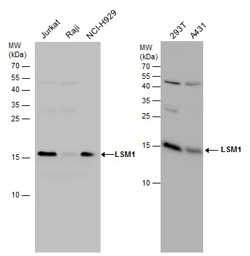 LSM1 antibody