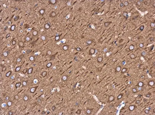 beta Tubulin 3/ TUJ1 antibody detects beta Tubulin 3/ TUJ1 protein at cytoplasm in rat brain by immunohistochemical analysis. Sample: Paraffin-embedded rat brain. beta Tubulin 3/ TUJ1 antibody (GTX130245) diluted at 1:500. 
 Antigen Retrieval: Citrate buffer, pH 6.0, 15 min