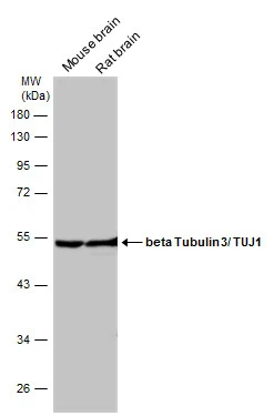 Various tissue extracts (50 μg) were separated by 10% SDS-PAGE, and the membrane was blotted with beta Tubulin 3/ TUJ1 antibody (GTX130245) diluted at 1:50000. Various tissue extracts (50 μg) were separated by 10% SDS-PAGE, and the membrane was blotted with beta Tubulin 3/ TUJ1 antibody (GTX130245) diluted at 1:50000.