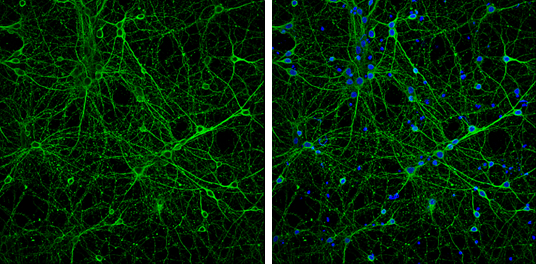 beta Tubulin 3/ Tuj1 antibody detects beta Tubulin 3/ Tuj1 protein at cytoplasm by immunofluorescent analysis. Sample: DIV9 rat E18 primary cortical neurons were fixed in 4% paraformaldehyde at RT for 15 min. Green: beta Tubulin 3/ Tuj1 protein stained by beta Tubulin 3/ Tuj1 antibody (GTX130245) diluted at 1:500. Blue: Fluoroshield with DAPI (GTX30920). beta Tubulin 3/ Tuj1 antibody detects beta Tubulin 3/ Tuj1 protein at cytoplasm by immunofluorescent analysis. Sample: DIV9 rat E18 primary cortical neurons were fixed in 4% paraformaldehyde at RT for 15 min. Green: beta Tubulin 3/ Tuj1 protein stained by beta Tubulin 3/ Tuj1 antibody (GTX130245) diluted at 1:500. Blue: Fluoroshield with DAPI (GTX30920).
