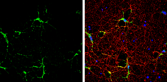 Anti-iNOS antibody (GTX130246) | GeneTex