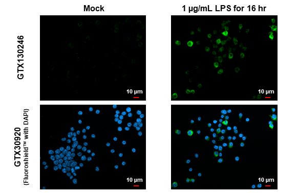 iNOS antibody detects iNOS protein by immunofluorescent analysis. Sample: Mock and treated Raw264.7 cells were fixed in 4% paraformaldehyde at RT for 15 min. Green: iNOS stained by iNOS antibody (GTX130246) diluted at 1:500. Blue: Fluoroshield with DAPI (GTX30920). iNOS antibody detects iNOS protein by immunofluorescent analysis. Sample: Mock and treated Raw264.7 cells were fixed in 4% paraformaldehyde at RT for 15 min. Green: iNOS stained by iNOS antibody (GTX130246) diluted at 1:500. Blue: Fluoroshield with DAPI (GTX30920).