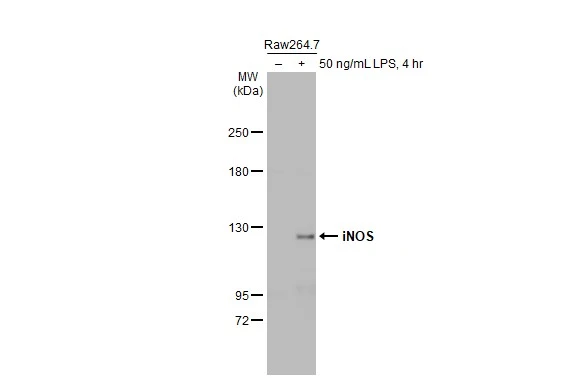 Untreated (–) and treated (+) Raw264.7 whole cell extracts (30 μg) were separated by 5% SDS-PAGE, and the membrane was blotted with iNOS antibody (GTX130246) diluted at 1:1000. The HRP-conjugated anti-rabbit IgG antibody (GTX213110-01) was used to detect the primary antibody. Untreated (–) and treated (+) Raw264.7 whole cell extracts (30 μg) were separated by 5% SDS-PAGE, and the membrane was blotted with iNOS antibody (GTX130246) diluted at 1:1000. The HRP-conjugated anti-rabbit IgG antibody (GTX213110-01) was used to detect the primary antibody.