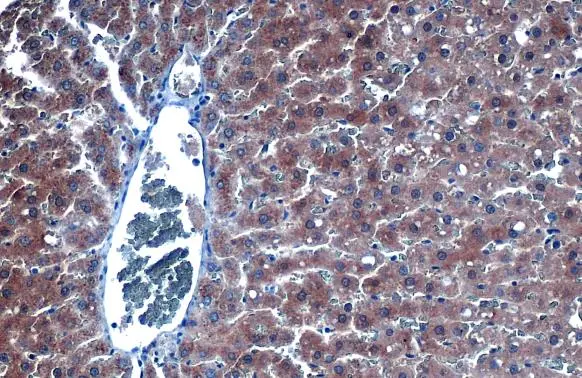 iNOS antibody detects iNOS protein at cytoplasm by immunohistochemical analysis. Sample: Paraffin-embedded rat liver. iNOS stained by iNOS antibody (GTX130246) diluted at 1:500. Antigen Retrieval: Citrate buffer, pH 6.0, 15 min iNOS antibody detects iNOS protein at cytoplasm by immunohistochemical analysis. Sample: Paraffin-embedded rat liver. iNOS stained by iNOS antibody (GTX130246) diluted at 1:500. Antigen Retrieval: Citrate buffer, pH 6.0, 15 min