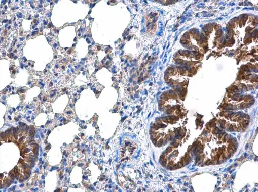 DOCK8 antibody detects DOCK8 protein at cytoplasm in mouse lung by immunohistochemical analysis. Sample: Paraffin-embedded mouse lung. DOCK8 antibody (GTX130251) diluted at 1:500. 
 Antigen Retrieval: Citrate buffer, pH 6.0, 15 min