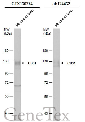 【中古】 pigment/ＣＤ/VPCC-81277 Anti-CD31 antibody [EPR17259] 20 ul size (ab182981) | Abcam