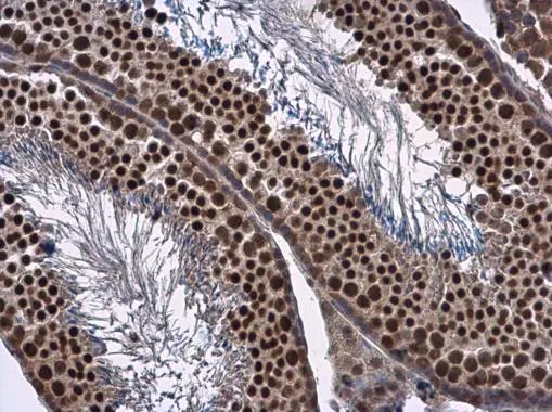 FOXO1 antibody detects FOXO1 protein at cytoplasm and nucleus in mouse testis by immunohistochemical analysis. Sample: Paraffin-embedded mouse testis. FOXO1 antibody (GTX130279) diluted at 1:500.
Antigen Retrieval: Citrate buffer, pH 6.0, 15 min