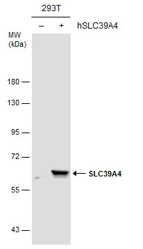 Non-transfected (–) and transfected (+) 293T whole cell extracts (30 μg) were separated by 7.5% SDS-PAGE, and the membrane was blotted with SLC39A4 antibody (GTX130285) diluted at 1:4000.