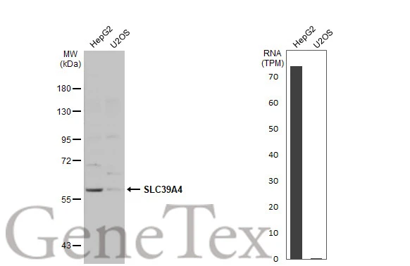 Various whole cell extracts (30 μg) were separated by 7.5% SDS-PAGE, and the membrane was blotted with SLC39A4 antibody (GTX130285) diluted at 1:1000. The HRP-conjugated anti-rabbit IgG antibody (GTX213110-01) was used to detect the primary antibody. Corresponding RNA expression data for the same cell lines are based on Human Protein Atlas program.