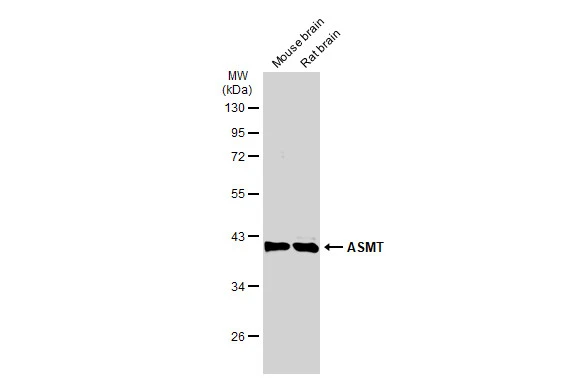Various tissue extracts (50 μg) were separated by 10% SDS-PAGE, and the membrane was blotted with ASMT antibody (GTX130292) diluted at 1:1000. The HRP-conjugated anti-rabbit IgG antibody (GTX213110-01) was used to detect the primary antibody.