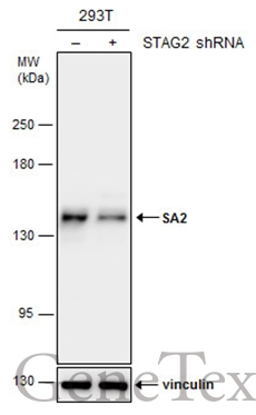 Non-transfected (–) and transfected (+) 293T whole cell extracts (30 μg) were separated by 5% SDS-PAGE, and the membrane was blotted with SA2 antibody (GTX130298) diluted at 1:5000. Non-transfected (–) and transfected (+) 293T whole cell extracts (30 μg) were separated by 5% SDS-PAGE, and the membrane was blotted with SA2 antibody (GTX130298) diluted at 1:5000.