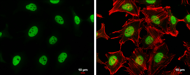 SA2 antibody detects SA2 protein at nucleus by immunofluorescent analysis. Sample: HeLa cells were fixed in 4% paraformaldehyde at RT for 15 min. Green: SA2 stained by SA2 antibody (GTX130298) diluted at 1:500. Red: phalloidin, a cytoskeleton marker, diluted at 1:100. Scale bar= 10μm.