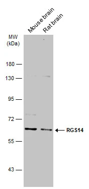 Various tissue extracts (50 μg) were separated by 7.5% SDS-PAGE, and the membrane was blotted with RGS14 antibody (GTX130309) diluted at 1:1000. The HRP-conjugated anti-rabbit IgG antibody (GTX213110-01) was used to detect the primary antibody.