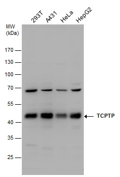 TCPTP antibody