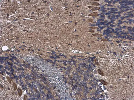TCPTP antibody detects TCPTP protein at cytoplasm in mouse brain by immunohistochemical analysis. Sample: Paraffin-embedded mouse brain. TCPTP antibody (GTX130319) diluted at 1:500. 
 Antigen Retrieval: Citrate buffer, pH 6.0, 15 min