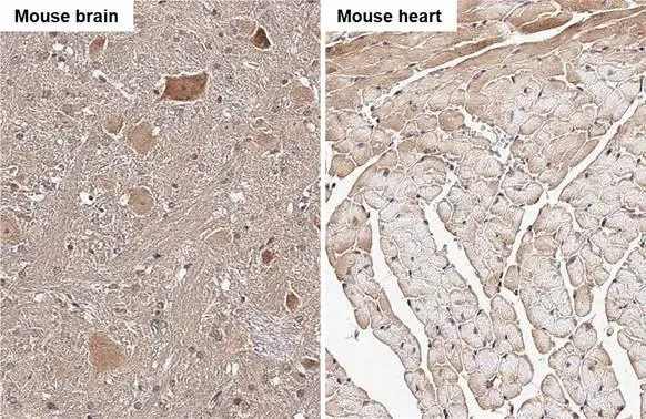 TCPTP antibody detects TCPTP protein by immunohistochemical analysis. Sample: Paraffin-embedded mouse tissues. TCPTP stained by TCPTP antibody (GTX130319) diluted at 1:500. Antigen Retrieval: Citrate buffer, pH 6.0, 15 min