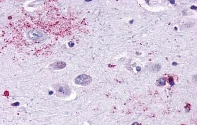 IHC-P analysis of human brain, neurons and glia tissue using GTX13032 MAS1 antibody. Antigen retrieval : Heat-induced antigen retrieval