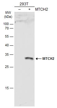 Non-transfected (–) and transfected (+) 293T whole cell extracts (30 μg) were separated by 12% SDS-PAGE, and the membrane was blotted with MTCH2 antibody (GTX130324) diluted at 1:1000. The HRP-conjugated anti-rabbit IgG antibody (GTX213110-01) was used to detect the primary antibody.