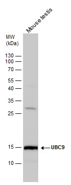 UBC9 antibody detects UBC9 protein by western blot analysis. Mouse tissue extracts (50 μg) was separated by 15 % SDS-PAGE, and the membrane was blotted with UBC9 antibody (GTX130355) diluted by 1:1600.