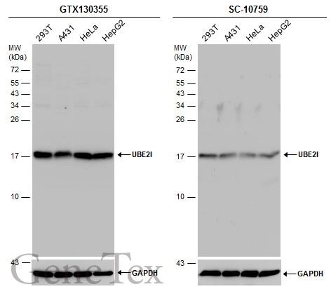 Various whole cell extracts (30 μg) were separated by 15% SDS-PAGE, and the membranes were blotted with UBE2I antibody (GTX130355) diluted at 1:1000 and competitor's antibody (SC-10759) diluted by 1:500.