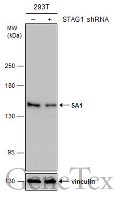 Non-transfected (–) and transfected (+) 293T whole cell extracts (30 μg) were separated by 5% SDS-PAGE, and the membrane was blotted with SA1 antibody (GTX130364) diluted at 1:3000. Non-transfected (–) and transfected (+) 293T whole cell extracts (30 μg) were separated by 5% SDS-PAGE, and the membrane was blotted with SA1 antibody (GTX130364) diluted at 1:3000.