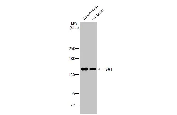 Various tissue extracts (50 μg) were separated by 5% SDS-PAGE, and the membrane was blotted with SA1 antibody (GTX130364) diluted at 1:1000. The HRP-conjugated anti-rabbit IgG antibody (GTX213110-01) was used to detect the primary antibody. Various tissue extracts (50 μg) were separated by 5% SDS-PAGE, and the membrane was blotted with SA1 antibody (GTX130364) diluted at 1:1000. The HRP-conjugated anti-rabbit IgG antibody (GTX213110-01) was used to detect the primary antibody.