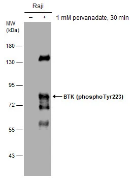 BTK (phospho Tyr223) antibody