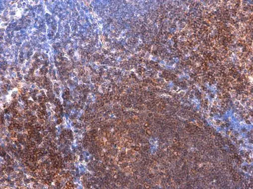 BTK (phospho Tyr223) antibody