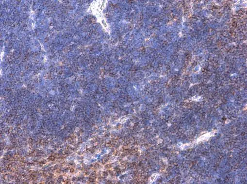 BTK (phospho Tyr223) antibody